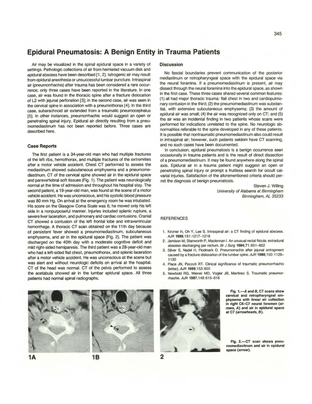 PDF extract preview
