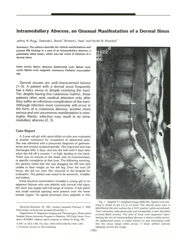 PDF extract preview