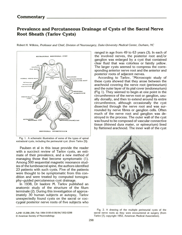 PDF extract preview