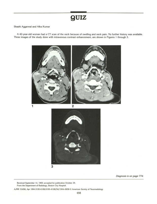 PDF extract preview