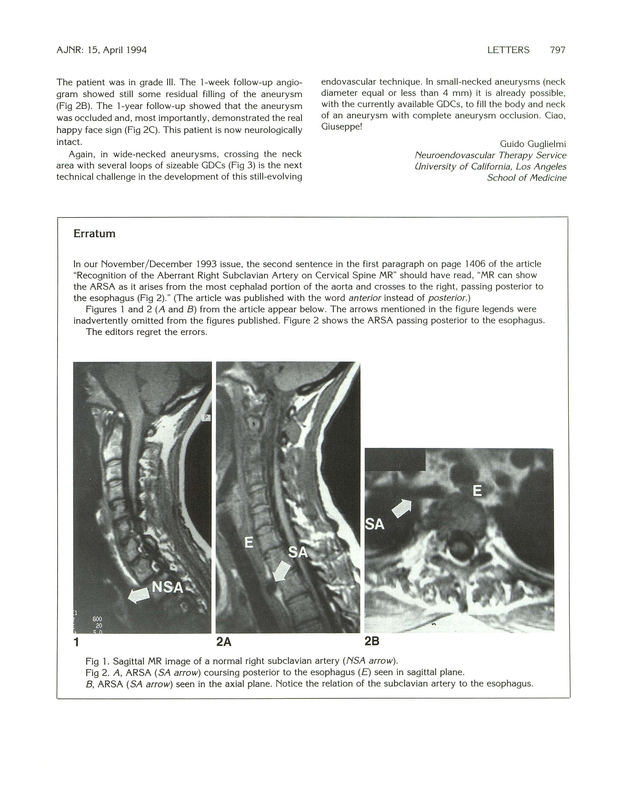 PDF extract preview