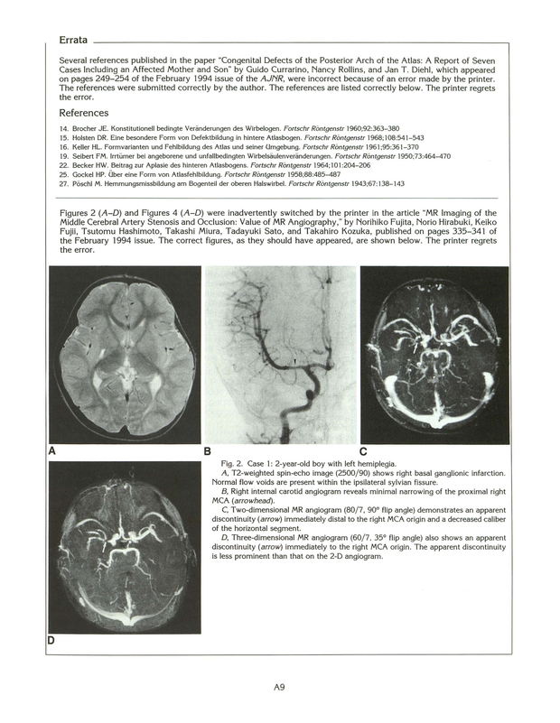PDF extract preview