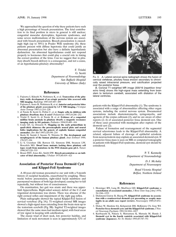 PDF extract preview
