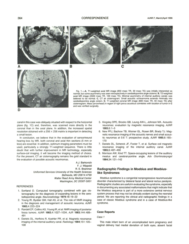 PDF extract preview