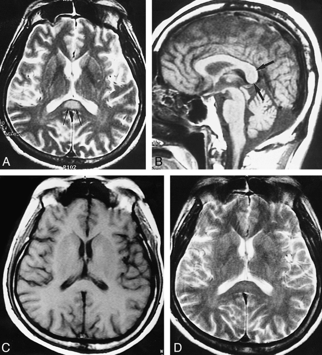 fig 3.