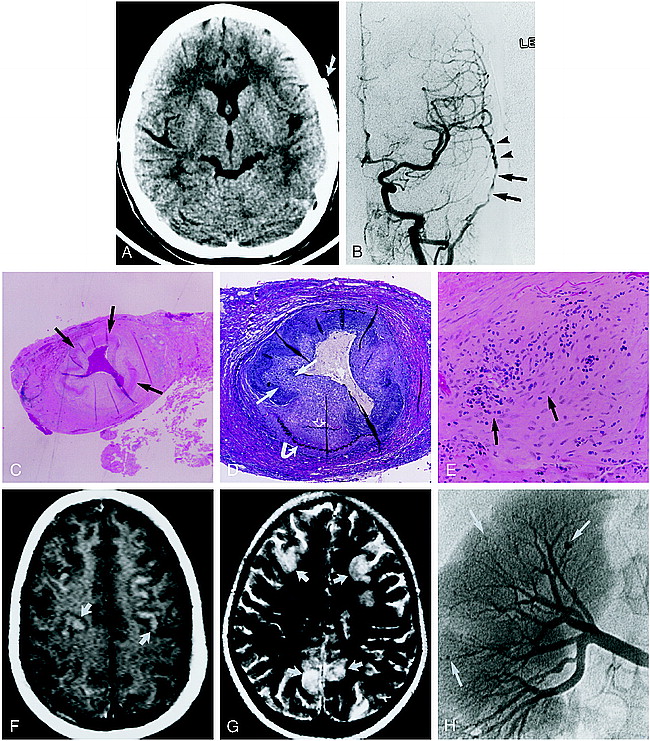 fig 1.