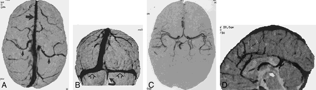 fig 1.