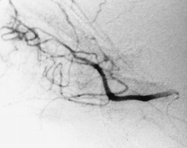 fig 1.