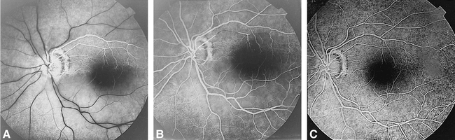 fig 2.