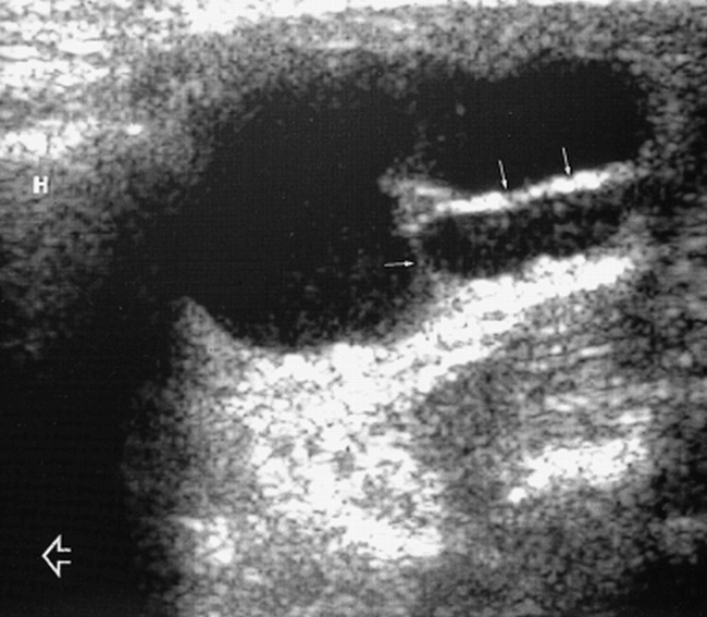 fig 5.