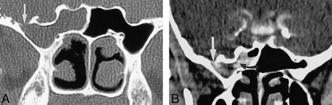 fig 4.