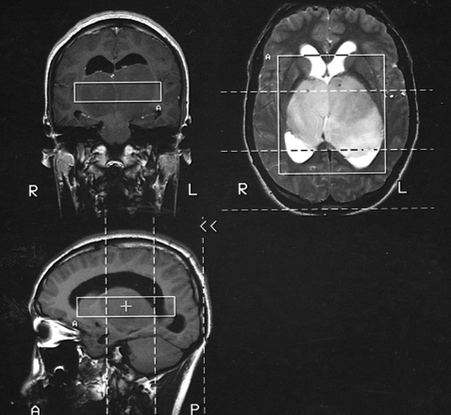 fig 2.
