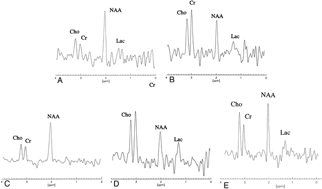 fig 4.