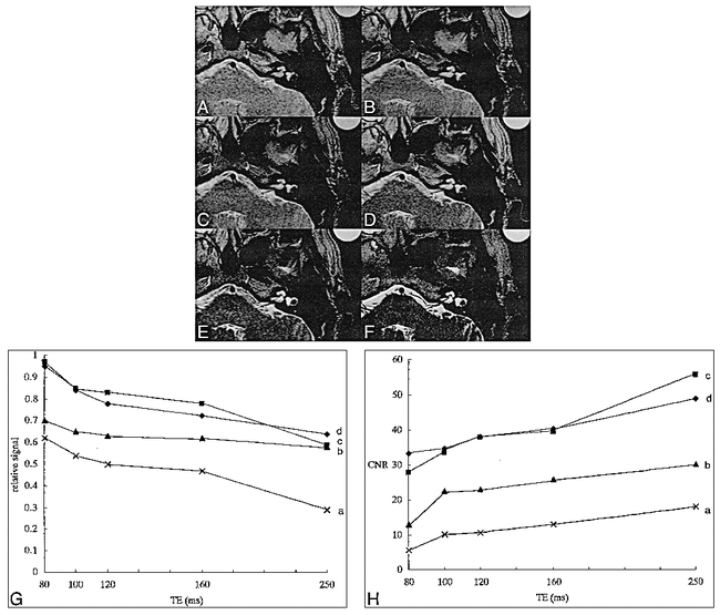 fig 4.