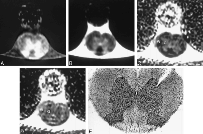 fig 1.