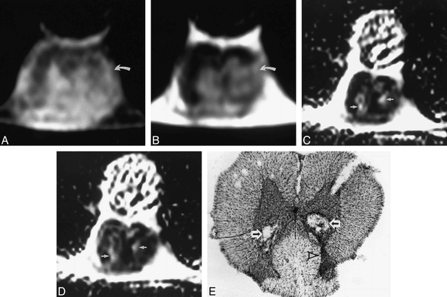 fig 2.