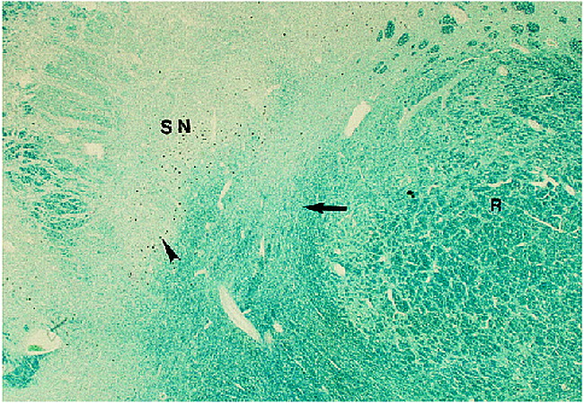 fig 1.