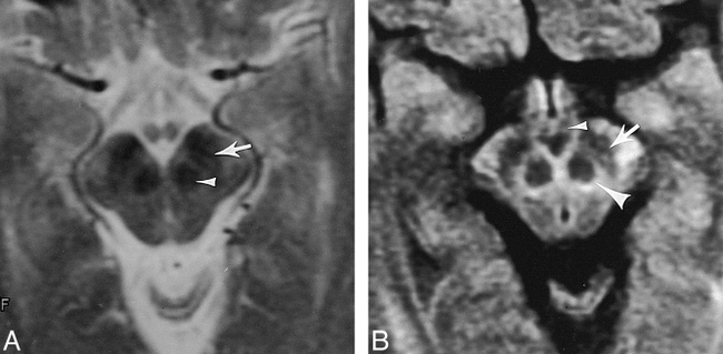 fig 2.