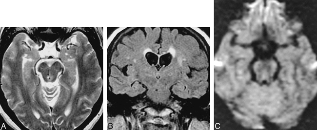 fig 3.