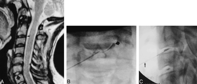 fig 3.