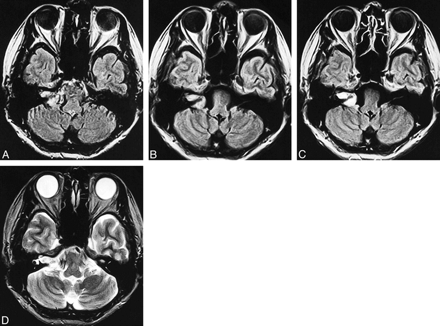 fig 3.