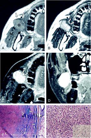 fig 1.