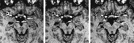 fig 1.