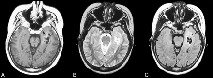 fig 1.
