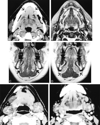 fig 3.