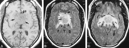 fig 3.