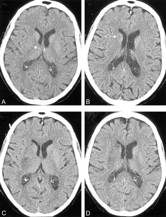 fig 4.