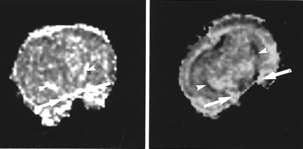 fig 3.