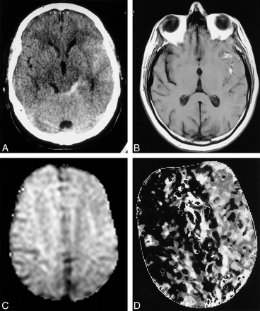 fig 3.