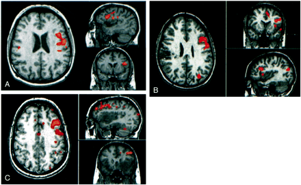 fig 1.