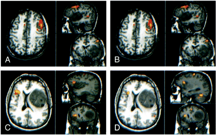 fig 3.