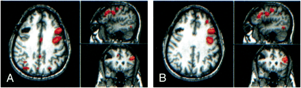 fig 5.