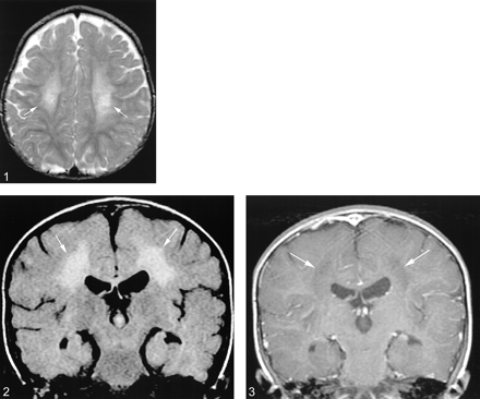fig 1.