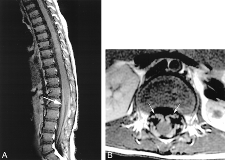 fig 4.