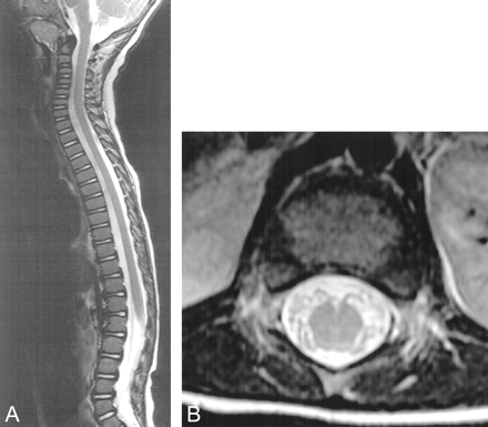 fig 5.