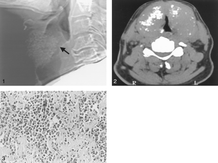 Fig 1.