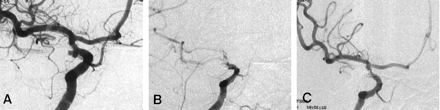 Fig 2.