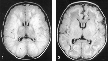 Fig 2.
