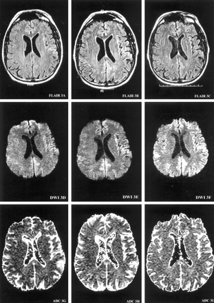 Fig 1.