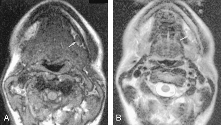 Fig 2.