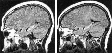 Fig 1.