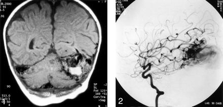 Fig 1.