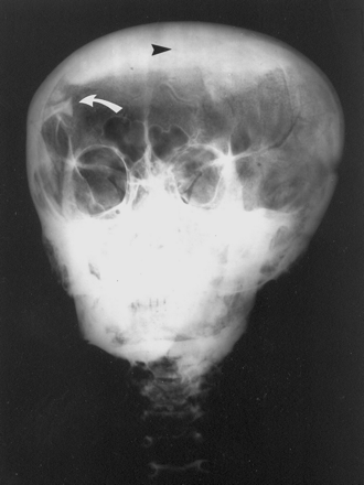 Fig 2.