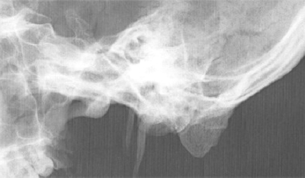Fig 5.