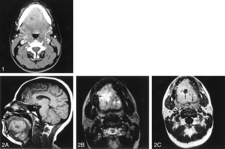 Fig 1.