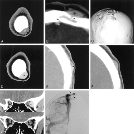 Fig 1.